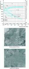 Figure 26 - Isothermal patenting treatment and structural refinement (Crédit AM)