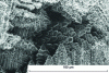 Figure 10 - Detail of figure  in the dendritic zone of the microreassures. As-cast X120Mn12 steel, SEM