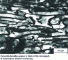 Figure 14 - Microstructure of pearlitic steel after wire drawing (IRSID photo)