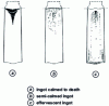 Figure 12 - Internal structure of ingots according to calming intensity (from )