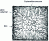Figure 13 - Schematic representation of an ingot cross-section showing the three crystallization zones