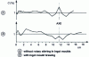 Figure 21 - Carbon concentration profiles along a radius in a continuously cast 100 C 6 steel billet