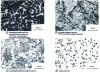 Figure 30 - Microstructure of cast iron pipes