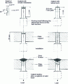 Figure 38 - Implant trial diagram