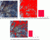 Figure 5 - Image analysis is used to estimate the residual austenite content in 100 Cr6 steel. This example highlights the extreme importance of threshold adjustment in the case of an image with many shades of gray.