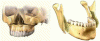 Figure 5 - Maxillary (left) and mandibular (right) osteotomy (Photo credits: Laboratoire TIMC-IMAG &CHU de Toulouse)