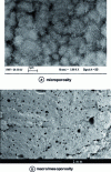 Figure 5 - Micrographs illustrating the porosity of phosphocalcic cements (Graftys® phosphocalcic cements)