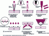 Figure 5 - Optical nanosources for nanophotolithography