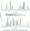 Figure 12 - Ion separation by ion chromatography