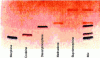Figure 19 - Separation of opiates and narcotics by HPTLC. 10 × 20 cm glass plate covered with a 0.2 mm layer of silica F254. 5 μl of solution applied in 2 cm strips by a Linomat IV (Camag). Elution with ethyl acetate/dichloromethane 50/50 v/v. Revelation with potassium iodoplatinate