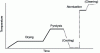 Figure 10 - Sample electrothermal program