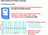 Figure 7 - Simultaneous dual-frequency excitation (Doc. Krohne)