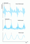 Figure 14 - Detecting and locating bearing defects