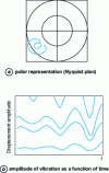 Figure 5 - Soft" friction on lubricated joints as seen by monitoring systems