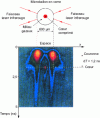 Figure 15 - Analysis of plasma created by laser-matter interaction (inertial confinement experiment) (based on document CEA-DAM, Limeil-Valenton Research Center)