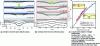 Figure 2 - Variation in the deformation of the interface of a demixed microemulsion as the laser power P increases, using a continuous Ar+ laser beam (wavelength in vacuum: λ0 = 514 nm) and a beam size ω0. The theoretical profiles (solid lines) are calculated from the expression for h(r, t = ∞). The control parameters are (a) ω0 = 14.6 µm and (T − Tc) = 2 K, (b) ω0 = 7.5 µm and (T − Tc) = 3 K [4]