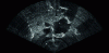 Figure 18 - Example of an acoustic image of several rocks lying on a sedimentary bed, obtained by a Blueprint Oculus M1200d acoustic camera set at 1.2 MHz (credit: DRASSM).
