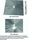 Figure 4 - Numerical simulation of HRTFs using boundary finite elements: sound pressure amplitude around a human bust model