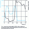 Figure 3 - Variation in the normal force exerted on the hip joint and the angular velocity of the joint during a person's normal gait