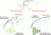 Figure 9 - Methods to determine the shape and
size of the wheel-rail contact patch by simulation (O.
Polach)
