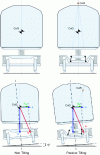 Figure 15 - Passive tilting system concepts (G. Hauser)